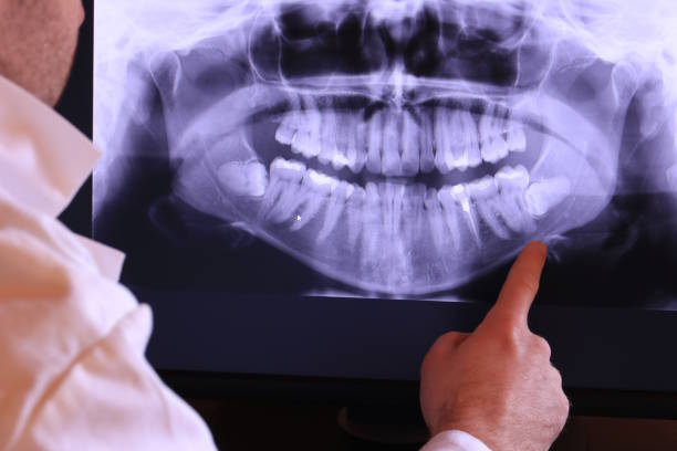 Best Emergency Dental Care for Sports Injuries in Badieville, LA