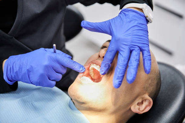 Best Broken or Chipped Tooth Repair in Badieville, LA