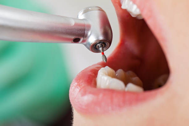 Best Emergency Care for Gum Disease in Badieville, LA